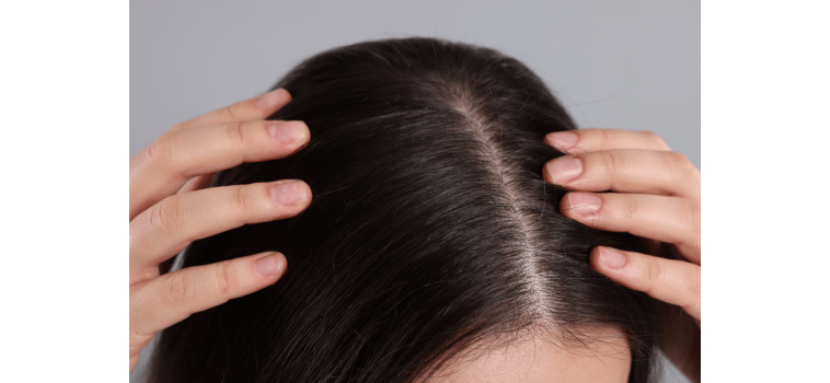 Comment prendre soin de son cuir chevelu ?